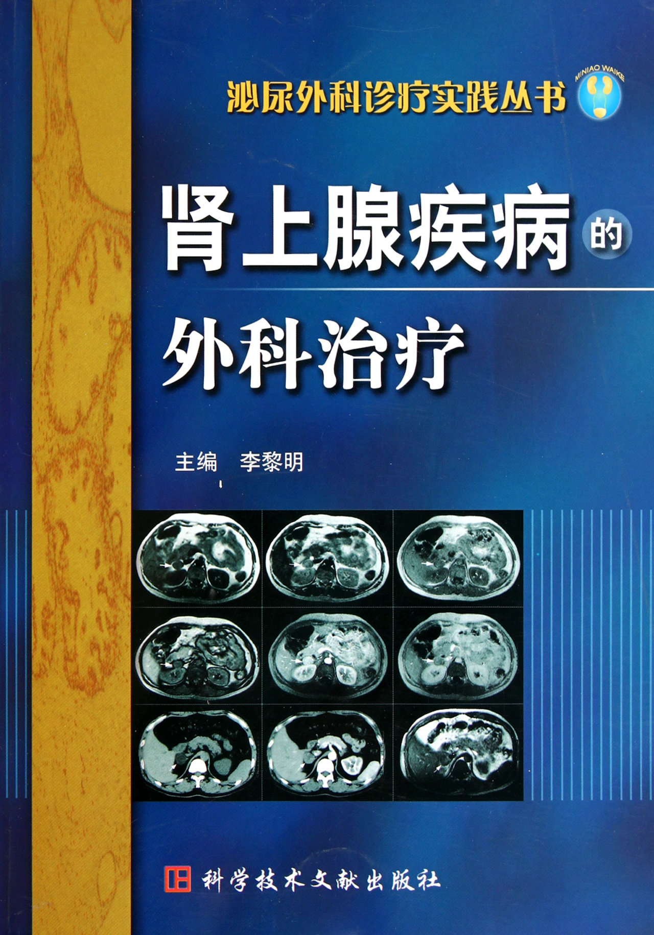肾上腺疾病的外科治疗\/泌尿外科诊疗实践丛书