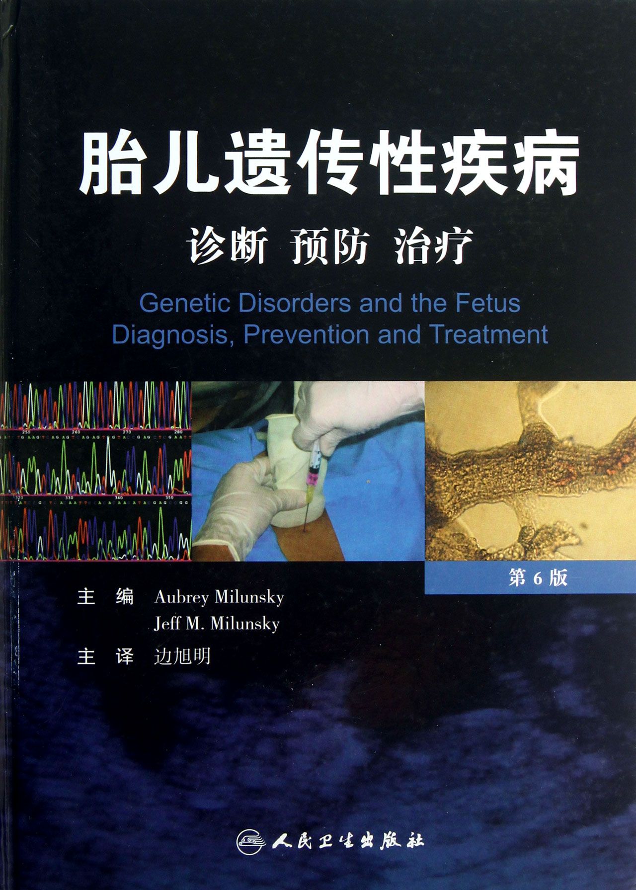胎儿遗传性疾病(诊断预防治疗第6版)(精)