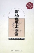 胃肠癌手术图谱(医学图谱系列)(精)
