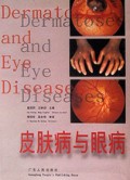 皮肤病与眼病