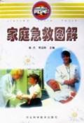 家庭急救图解
