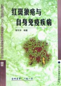 红斑狼疮与自身免疫疾病