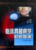 临床真菌病学彩色图谱