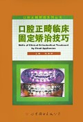 口腔正畸临床固定矫治技巧/口腔正畸矫治系列丛书