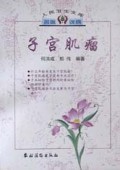 子宫肌瘤/人民卫生文库