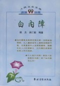 白内障/人民卫生文库