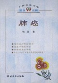 肺癌/人民卫生文库