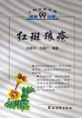 红斑狼疮/人民卫生文库