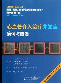 心血管介入治疗并发症病例与图谱(附光盘)
