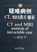 疑难病例CT\MRI读片解析(精)