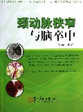 颈动脉狭窄与脑卒中